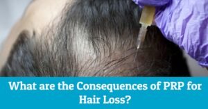 prp hair treatment -What are the Consequences of PRP for hair loss?