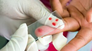 Malaria Diagnostics Market